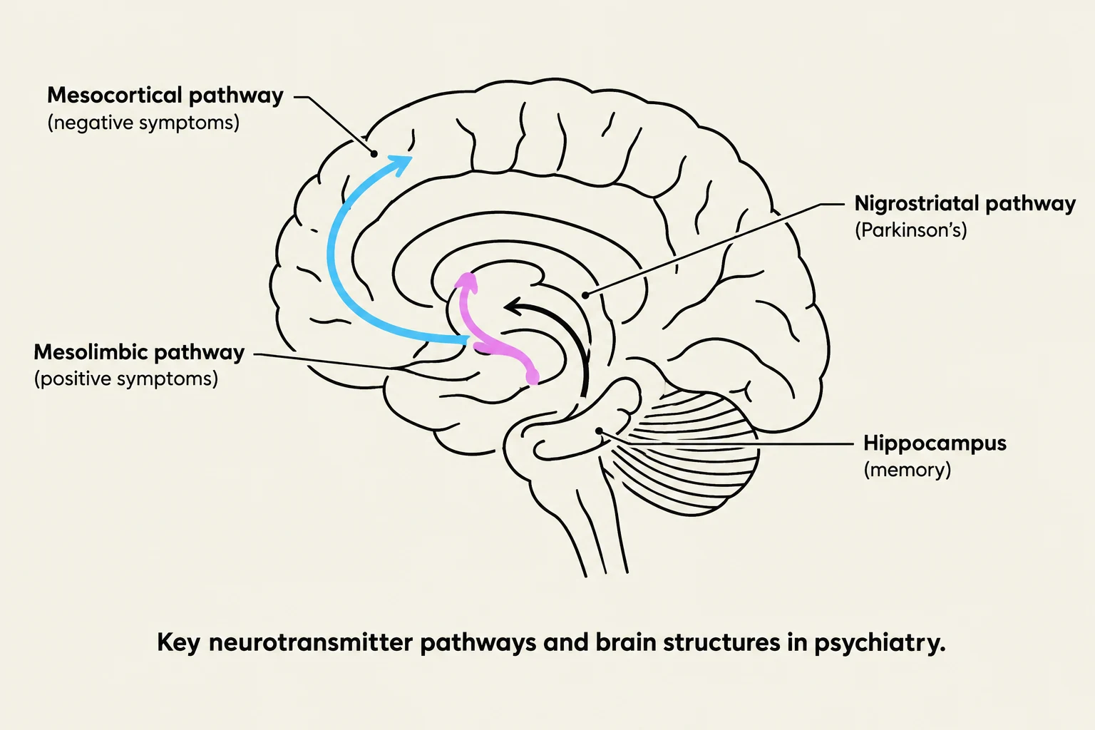 Diagram illustrating key neurotransmitter pathways and brain structures relevant to psychiatric conditions, including the mesocortical, mesolimbic, and nigrostriatal pathways, as well as the hippocampus.