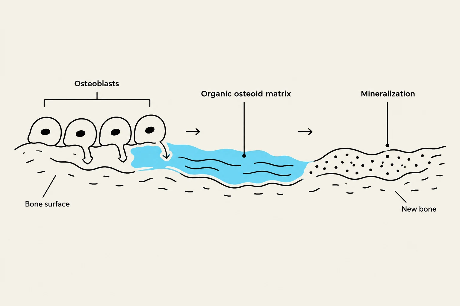 Diagram illustrating the process of bone formation, showing osteoblasts secreting organic osteoid matrix which then undergoes mineralization to form new bone.