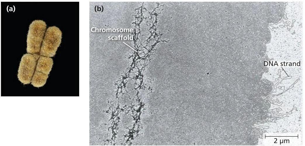 Image (a) shows a chromosome, and image (b) is a scanning electron micrograph illustrating the chromosome scaffold and DNA strand.