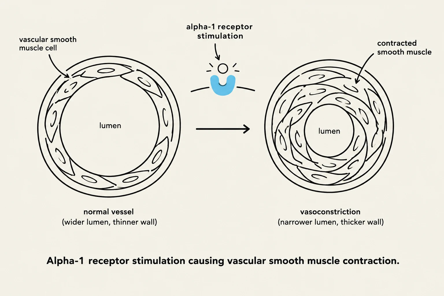 Alpha-1 receptor stimulation causes vascular smooth muscle contraction, leading to vasoconstriction.