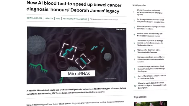 News headlines highlighting microRNA as a cancer diagnostic.