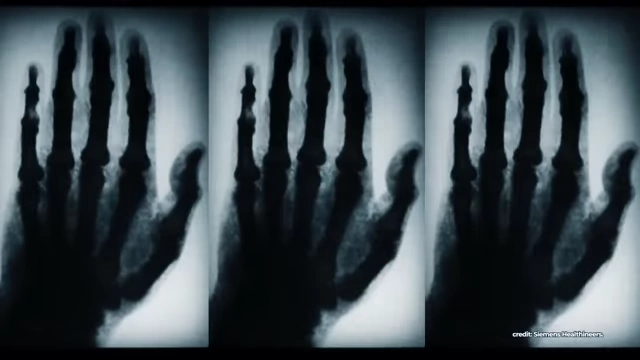 X-ray images, demonstrating early imaging technology.