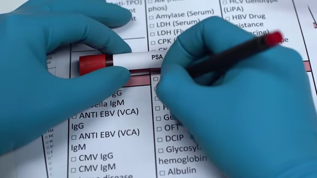 A blood test request form listing PSA, a tumor marker.