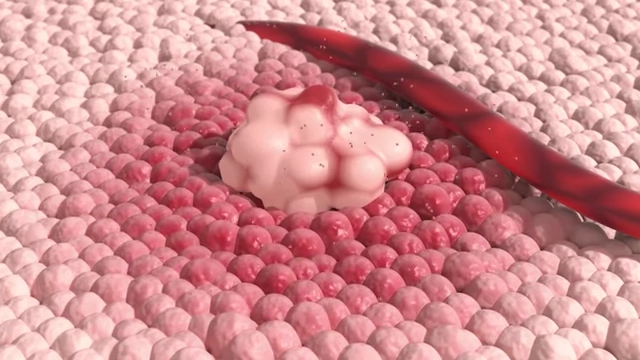 Cancer cells releasing altered microRNAs that affect surrounding healthy cells.