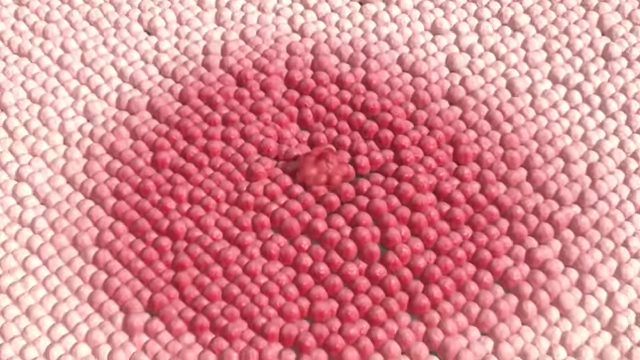 An animation showing the systemic spread of cancer signals through the body's tissues.