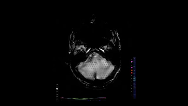 An MRI scan of a human brain, relating to DeepMind's inspiration