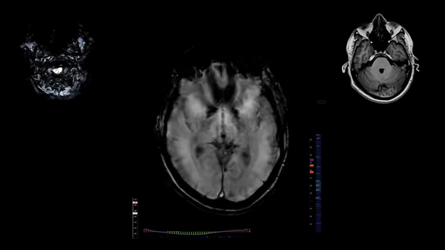 An MRI scan of a human brain, representing the complexity rationalism attempts to reduce