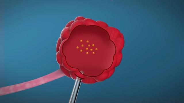 Animated diagram showing a needle aspirating eggs from an ovary during the retrieval process