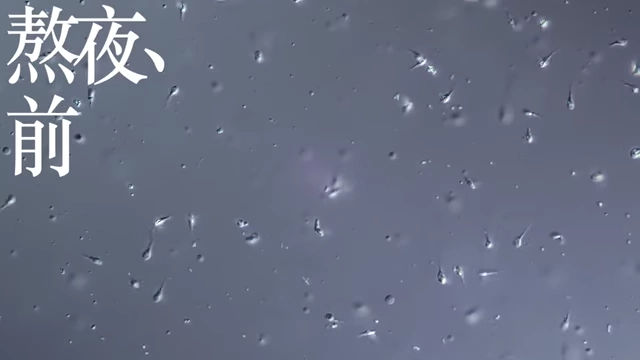 熬夜前精子在显微镜下的活跃状态