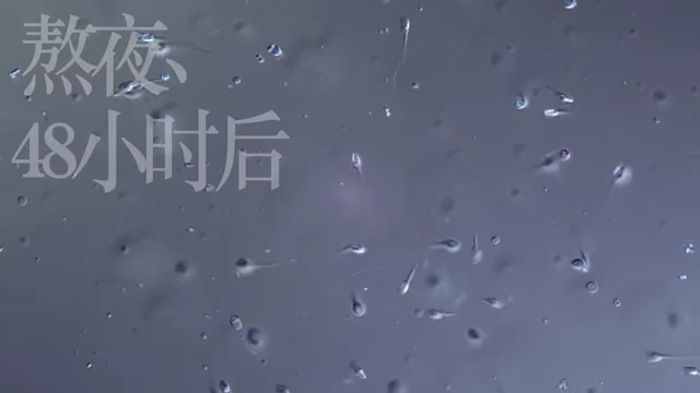 熬夜48小时后精子在显微镜下的活跃状态，短期内未受明显影响