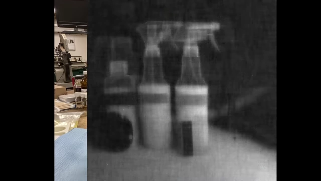 An X-ray backscatter image showing different materials