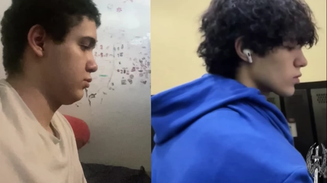 Side profile comparison showing the improvement in the speaker's facial structure and jawline