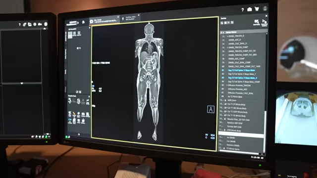 An MRI scan displayed on a monitor, showing a detailed 3D model of the human body for muscle analysis.