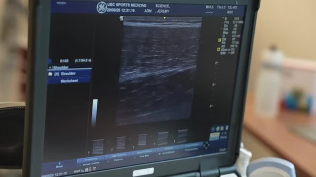 Ultrasound screen showing a 2D snapshot of muscle thickness, illustrating the common but limited measurement technique in past studies.