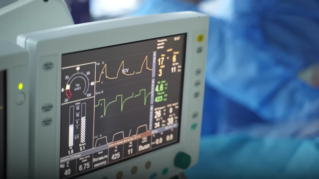 A heart monitor displaying irregular vital signs, symbolizing the speaker's cardiac event.