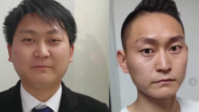 Xiao Ai's facial transformation from his initial pudgy appearance to a leaner, healthier look after balanced weight loss