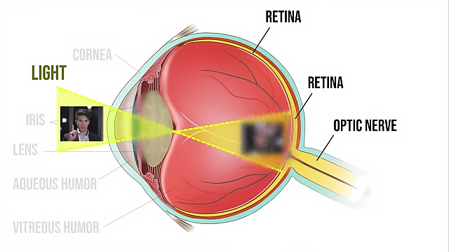 A diagram showing light entering the eye and focusing on the retina, which would typically result in clear vision.