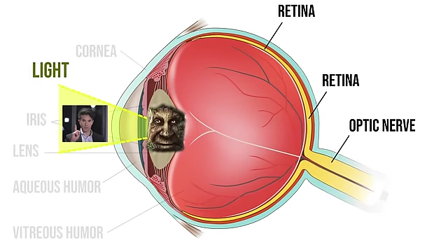 A diagram illustrating light entering the eye and reaching the retina, but the image is distorted or dark, indicating a problem in processing or transmission.