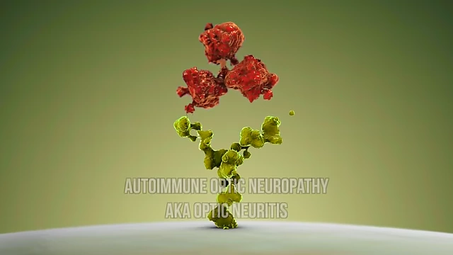 A diagram depicting autoimmune optic neuropathy, where the immune system attacks itself.