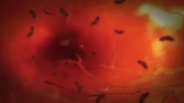 A microscopic view of bacteria, illustrating a potential infectious cause of vision loss that was ruled out.