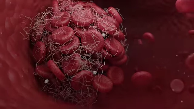 A magnified view of a blood clot forming, illustrating the process that Vitamin K facilitates.