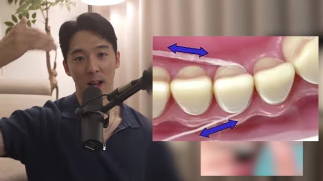 Diagram comparing how expanding floss and traditional floss interact with teeth to remove debris