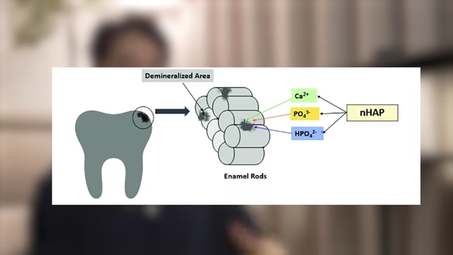 Diagram showing nano-hydroxyapatite (nHA) remineralizing demineralized enamel rods
