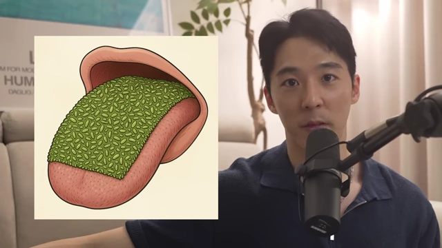 Illustration depicting a tongue surface as a "shag carpet" for bacteria and debris