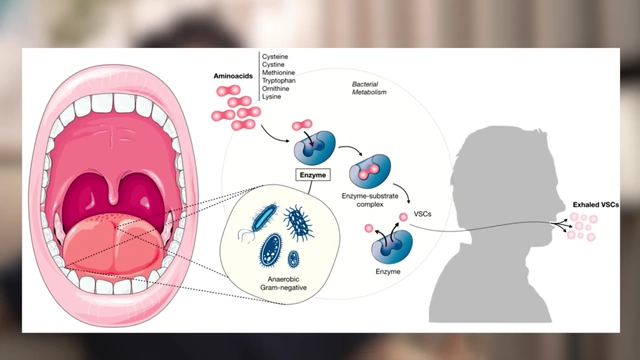 Diagram illustrating the bacterial metabolism of amino acids into volatile sulfur compounds, causing bad breath