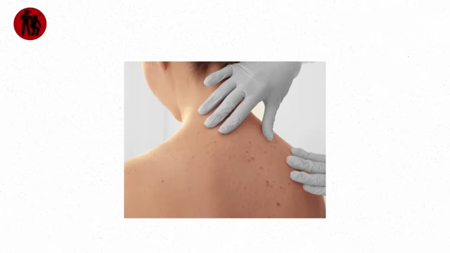 A person's back with visible skin damage being examined