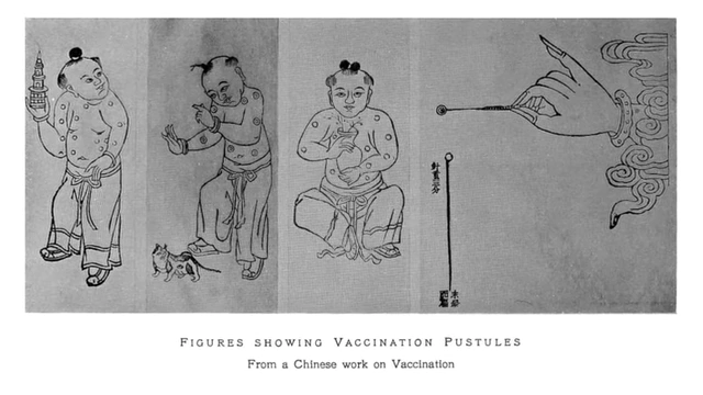 An illustration from an ancient Chinese work demonstrating figures and tools associated with variolation, an early form of inoculation against smallpox.