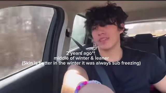 The vlogger's skin appearance two years ago during winter, illustrating his natural skin quality.