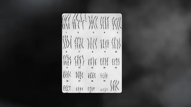 Human chromosomes, where genes are located
