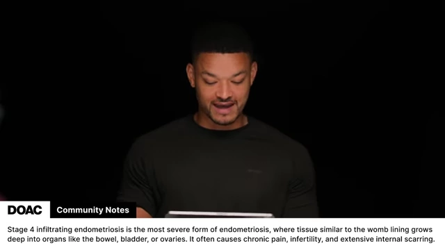 Community Notes describe Stage 4 infiltrating endometriosis as a severe form with tissue growth into organs.
