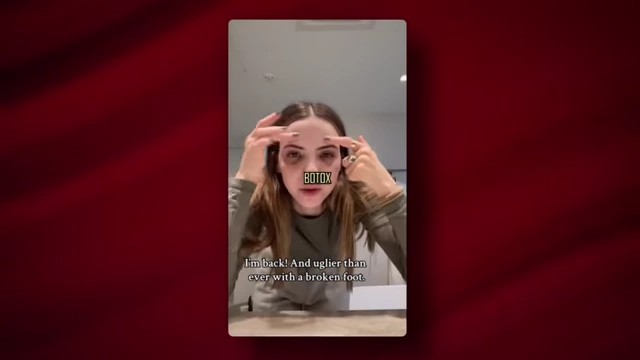 Bobbi Althoff showing her face post-cosmetic surgery, explaining forehead botox and under-eye filler.