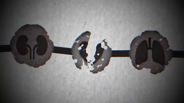 Illustration of human organs as links in a chain, showing some eroding