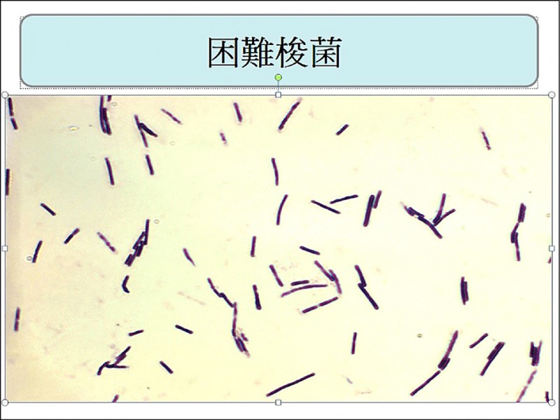 危險腸道感染新療法！美FDA批准首款糞菌藥丸