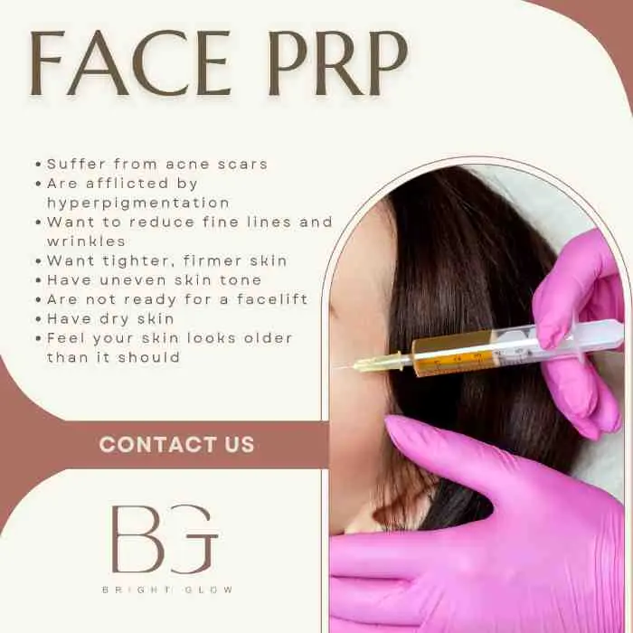 Face PRP