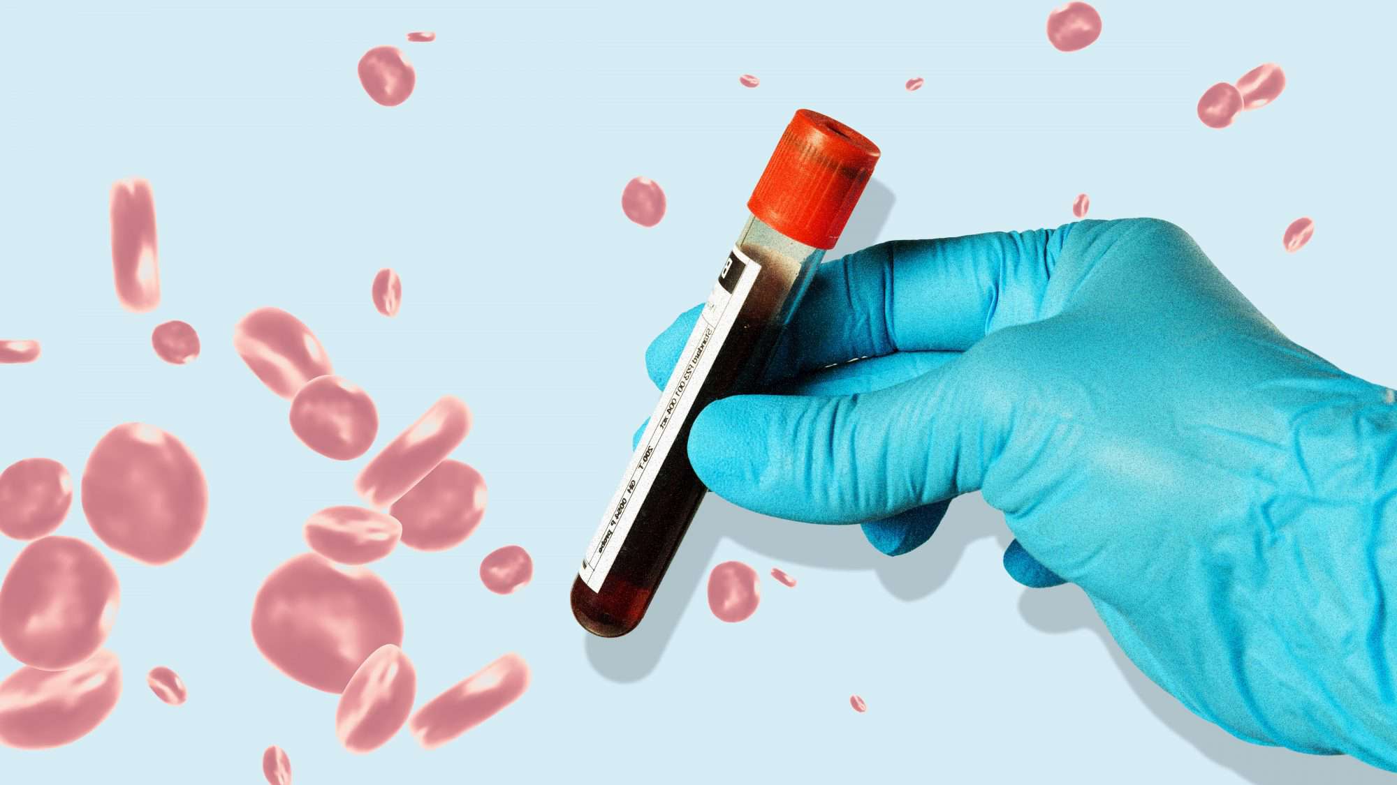 Full Body Checkup price