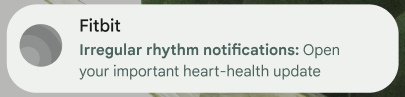 Irregular rhythm phone notification