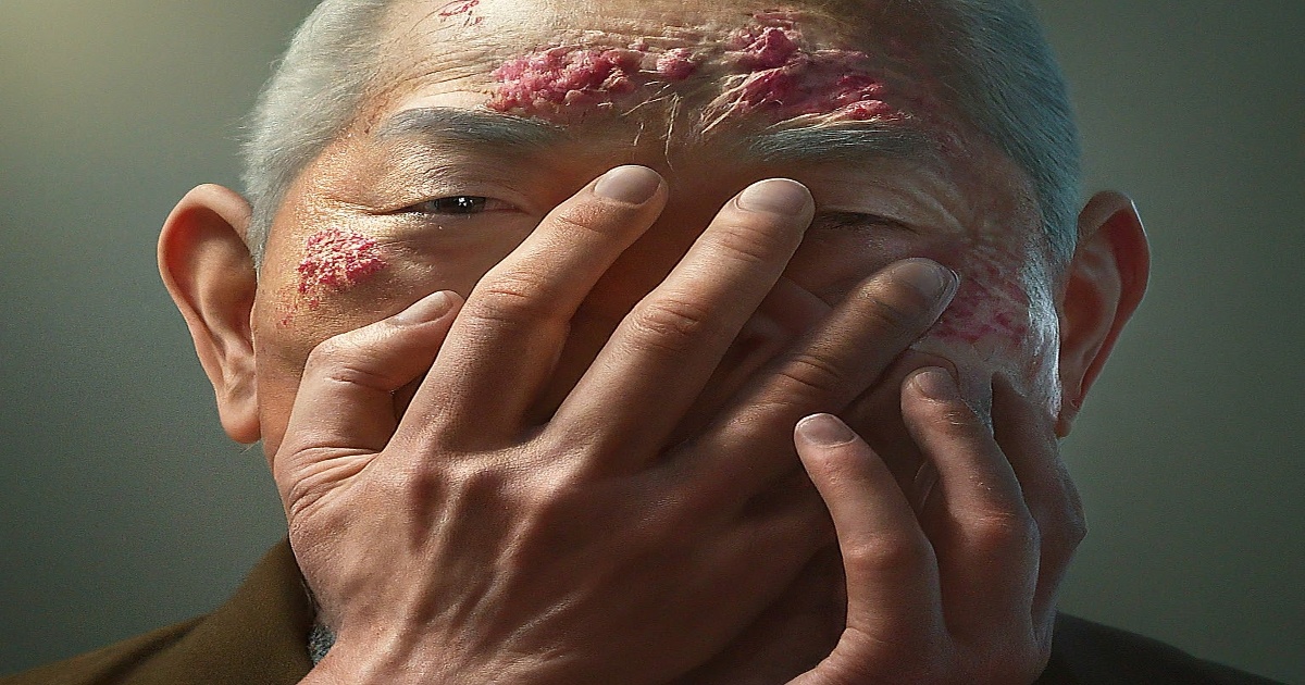 Main image to the post Beijing Observes Shingles Awareness Week to Boost Public Health Vigilance
