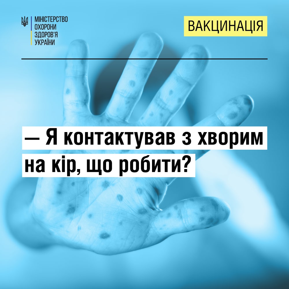 3e57cb03-571b-4565-95d2-14506bbfa686.jpg 3e57cb03-571b-4565-95d2-14506bbfa686.jpg
