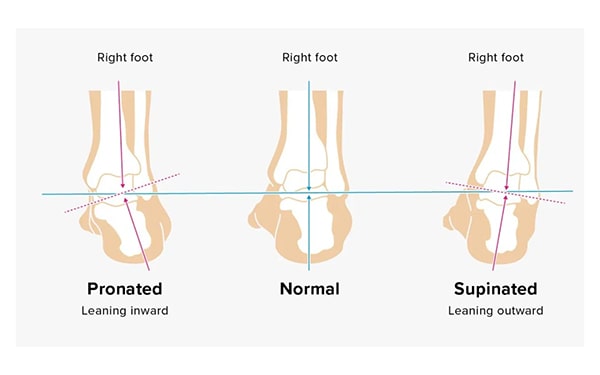 edfbc478 best running shoes in india pronation swag swami article