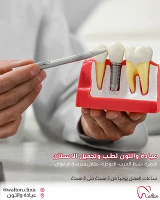 عيادة والتون لطب و تجميل الاسنان
