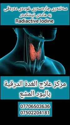 مركز علاج الغدة الدرقيه بليود المشع