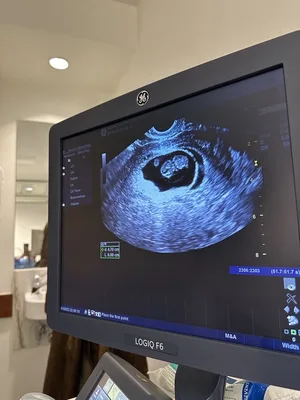 الفرزدق عماد عمران