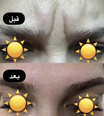 سرى شريف زينل