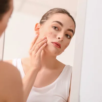 سنبل عبدالأمير غالب - الامراض الجلدية و الزهرية