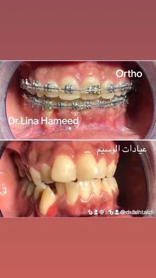 عيادات الوسيم لطب وتجميل وزراعة وتقويم الاسنان