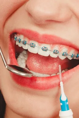 مصطفى عبدالرزاق زنگنه - طب الاسنان - جراحة الفم والوجه والفكين